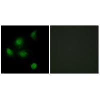Anti-SIN3B Antibody Anti-SIN3B Antibody