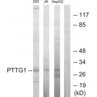 Anti-PTTG1 Antibody