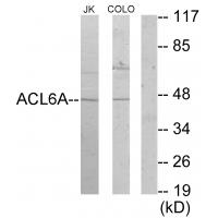 Anti-ACL6A Antibody