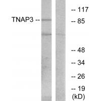 Anti-TNAP3 Antibody