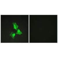 Anti-TNAP3 Antibody Anti-TNAP3 Antibody