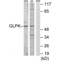 Anti-GLPK Antibody