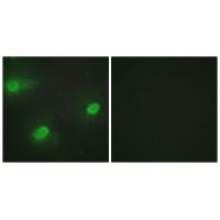 Anti-CSTF2 Antibody Anti-CSTF2 Antibody