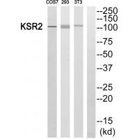 Anti-KSR2 Antibody