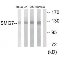 Anti-SMG7 Antibody