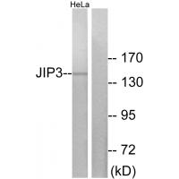 Anti-JIP3 Antibody