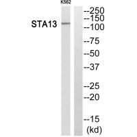 Anti-STA13 Antibody