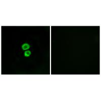Anti-IFM3 Antibody Anti-IFM3 Antibody
