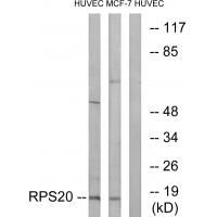 Anti-RPS20 Antibody