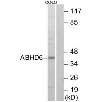 Anti-ABHD6 Antibody