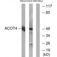 Anti-ACOT4 Antibody