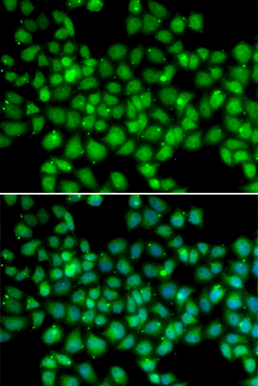 Anti-ARRB2 Antibody Anti-ARRB2 Antibody
