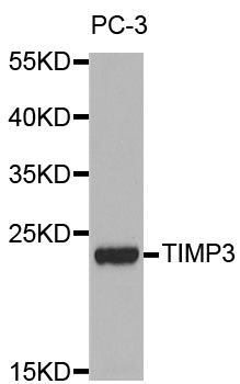 Anti-TIMP3 Antibody