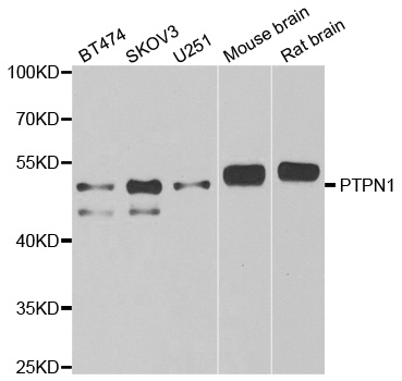 Anti-PTPN1 Antibody