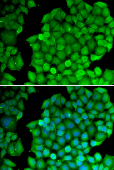 Anti-CCND2 Antibody Anti-CCND2 Antibody