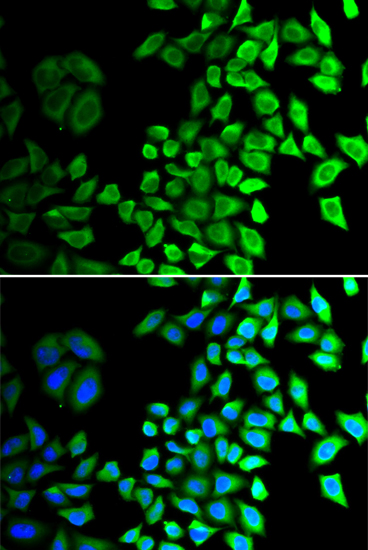 Anti-cdc45 Antibody Anti-cdc45 Antibody