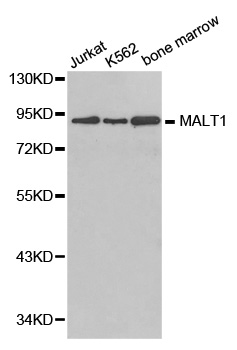 Anti-MALT1 Antibody