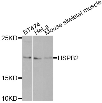 Anti-HSPB2 Antibody
