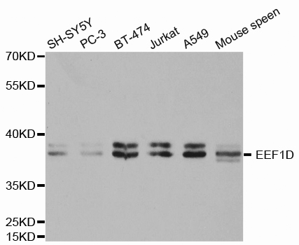 Anti-EEF1D Antibody