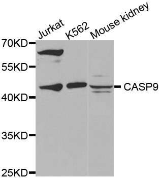 Anti-CASP9 Antibody