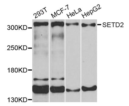 Anti-SETD2 Antibody