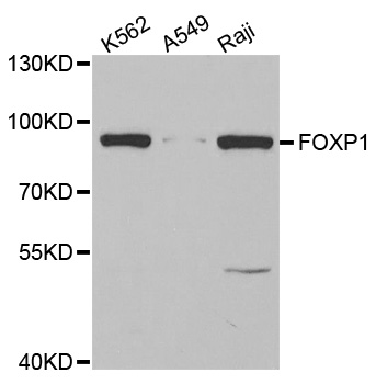 Anti-FOXP1 Antibody