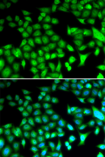 Anti-FOSL1 Antibody