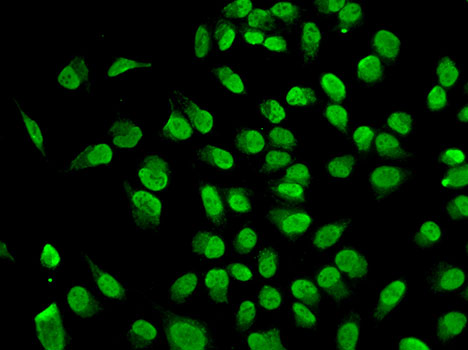 Anti-Dnmt1 Antibody Anti-Dnmt1 Antibody
