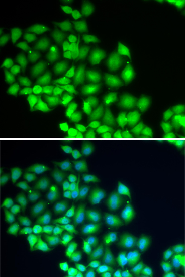 Anti-ERCC2 Antibody