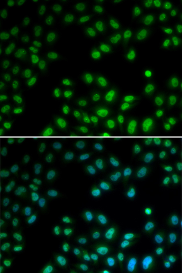 Anti-PIAS1 Antibody Anti-PIAS1 Antibody