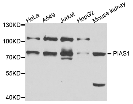 Anti-PIAS1 Antibody Anti-PIAS1 Antibody