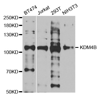 Anti-KDM4B Antibody