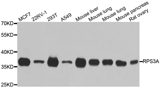 Anti-RPS3A Antibody