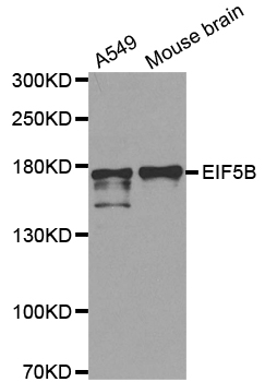 Anti-EIF5B Antibody