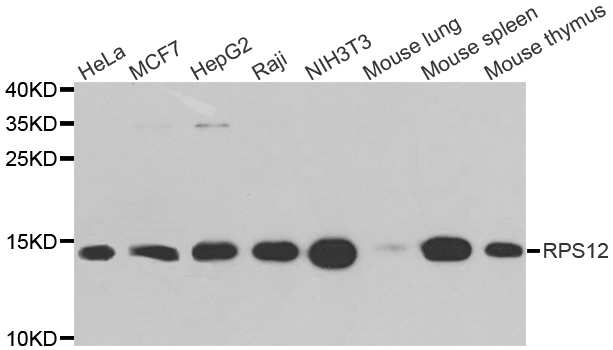 Anti-RPS12 Antibody