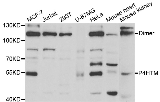 Anti-P4HTM Antibody