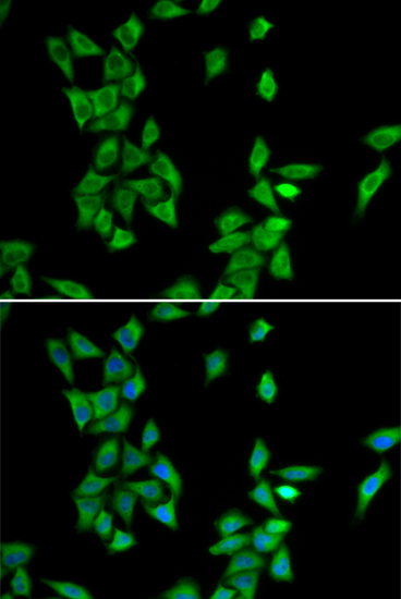 Anti-ANXA4 Antibody Anti-ANXA4 Antibody