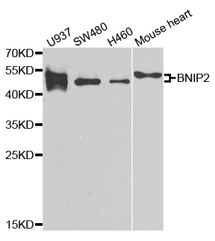 Anti-BNIP2 Antibody