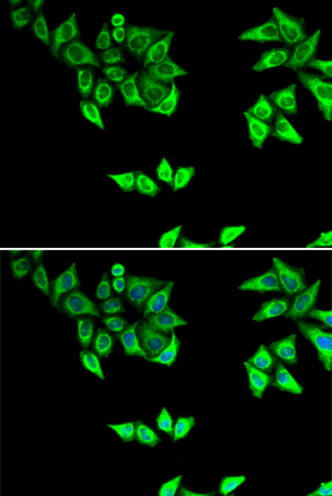 Anti-OXA1L Antibody Anti-OXA1L Antibody