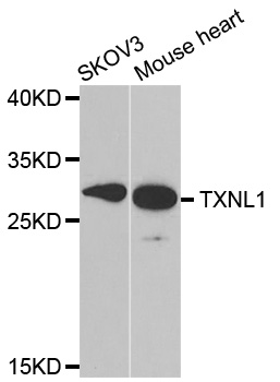 Anti-TXNL1 Antibody