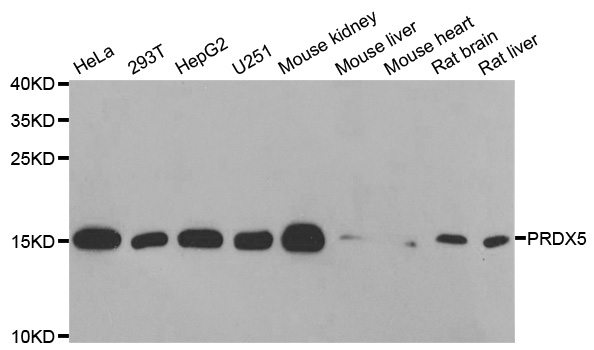 Anti-PRDX5 Antibody Anti-PRDX5 Antibody
