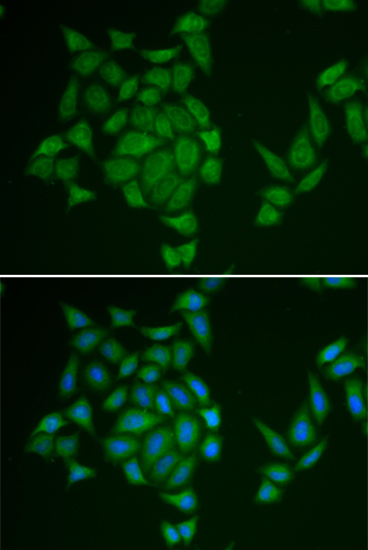 Anti-AMPD3 Antibody