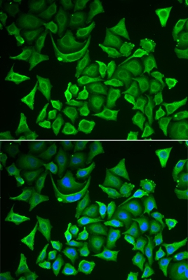 Anti-DTYMK Antibody Anti-DTYMK Antibody