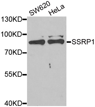 Anti-SSRP1 Antibody