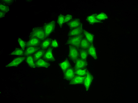 Anti-SSRP1 Antibody Anti-SSRP1 Antibody