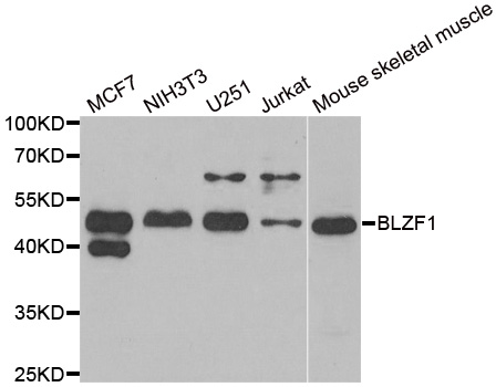 Anti-BLZF1 Antibody