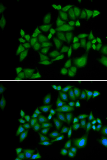 Anti-BLZF1 Antibody Anti-BLZF1 Antibody
