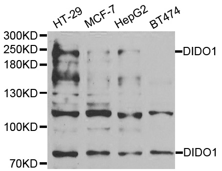 Anti-DIDO1 Antibody