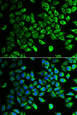 Anti-DDAH2 Antibody Anti-DDAH2 Antibody