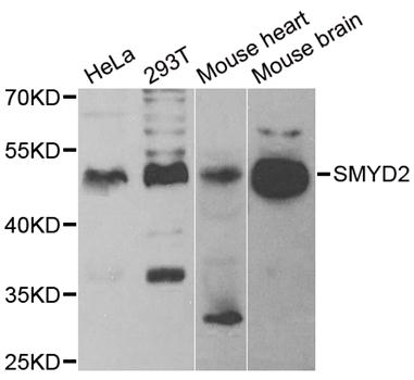 Anti-SMYD2 Antibody